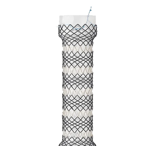 segmented-stent-1